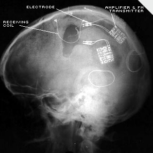 Brain-Machine Beta Testing