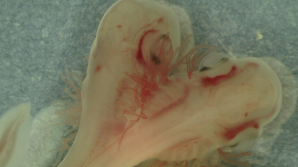 A double shark embryo