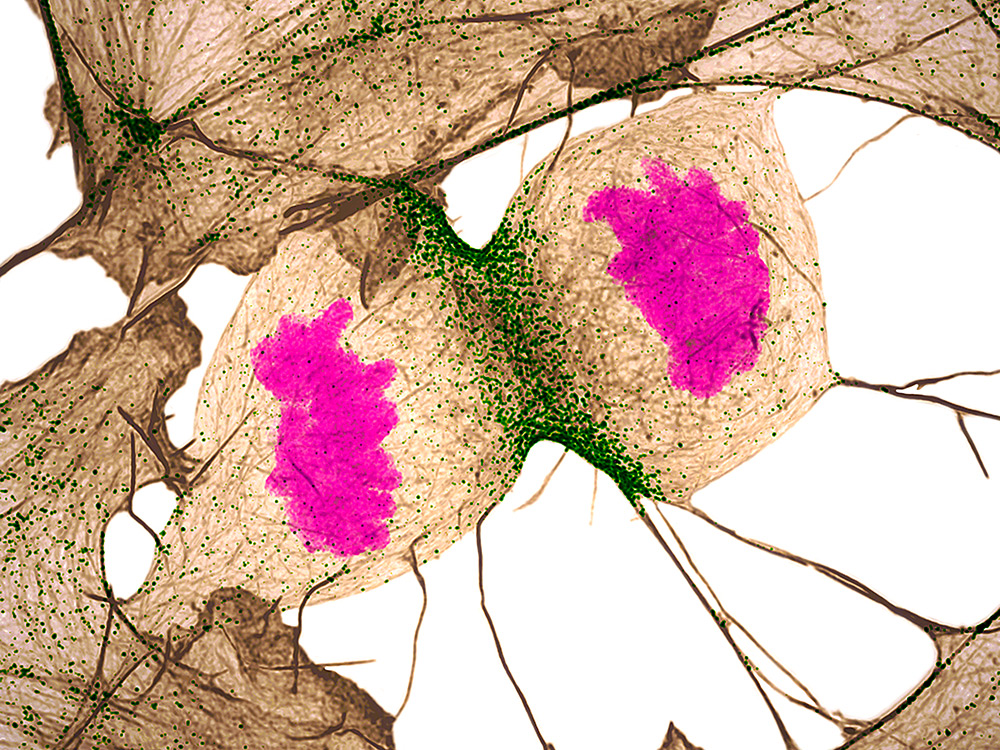 Human fibroblast undergoing cell division