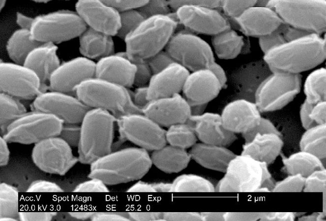 Anthrax Spores