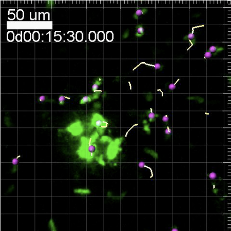 Video: Researchers Watch Type 1 Diabetes As It Unfolds, in Real Time