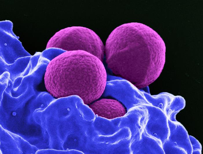 Staphylococcus aureus