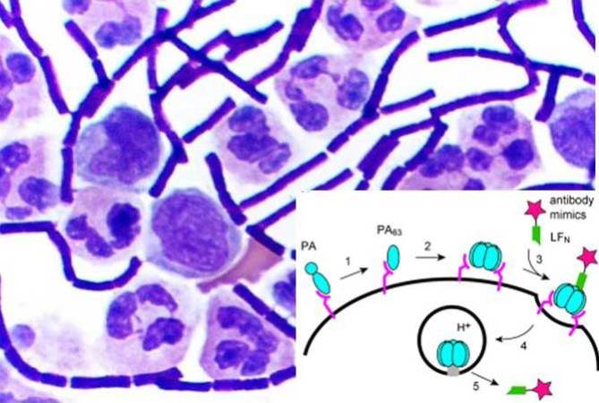 Using Anthrax In The Fight Against Cancer