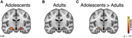 Teens Have An Edge When Learning From Rewards