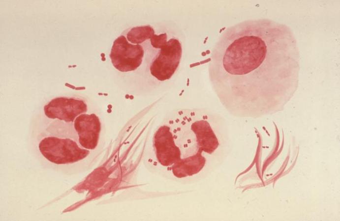 Fragment of Human DNA Found in Genome of Gonorrhea Bacteria