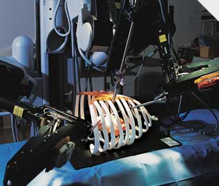 Da Vinci Surgical Robot