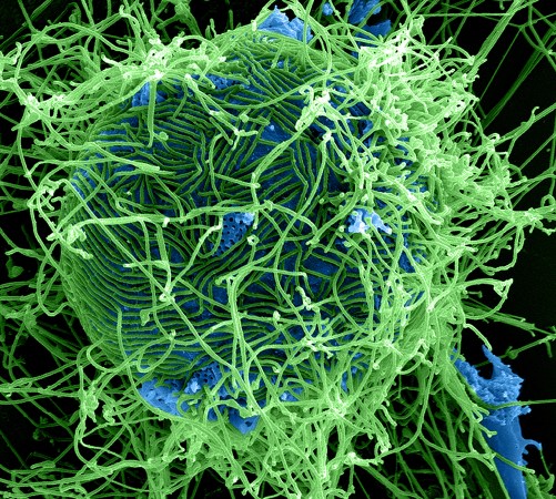 Four Predictions About The Ebola Outbreak