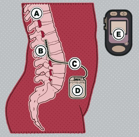 Scientists Regrow Severed Spinal Cords In Rats