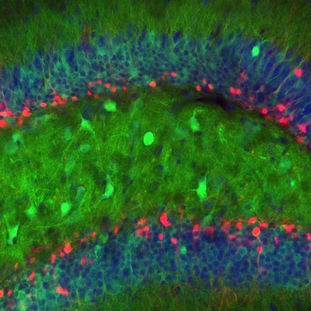 For The First Time, We’ve Seen Brand-New Neurons Firing