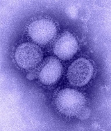 Swine Flu Consistent with Other Pandemic Strains