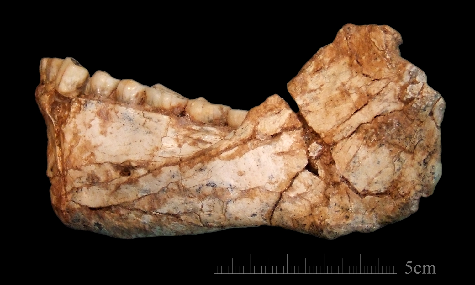 mandible