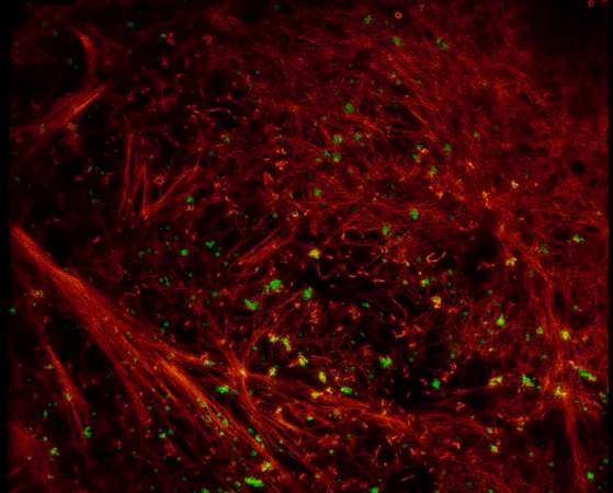 Watch The Inside Of A Cell Move In High Resolution