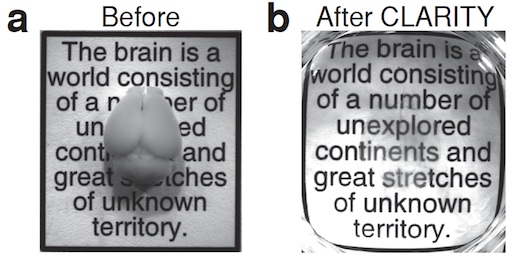 photos of a mouse brain before and after CLARITY treatment