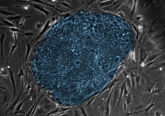 Modern Scientists Validate Alan Turing’s Theory About Biology