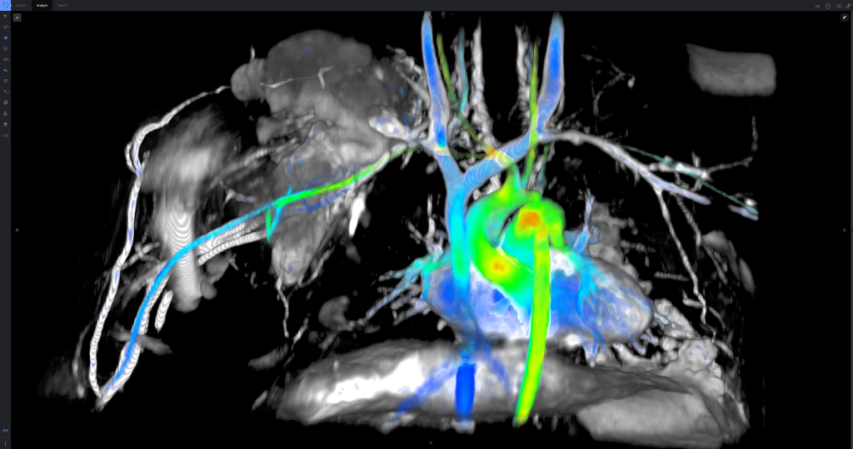 See The Human Heart Like Never Before