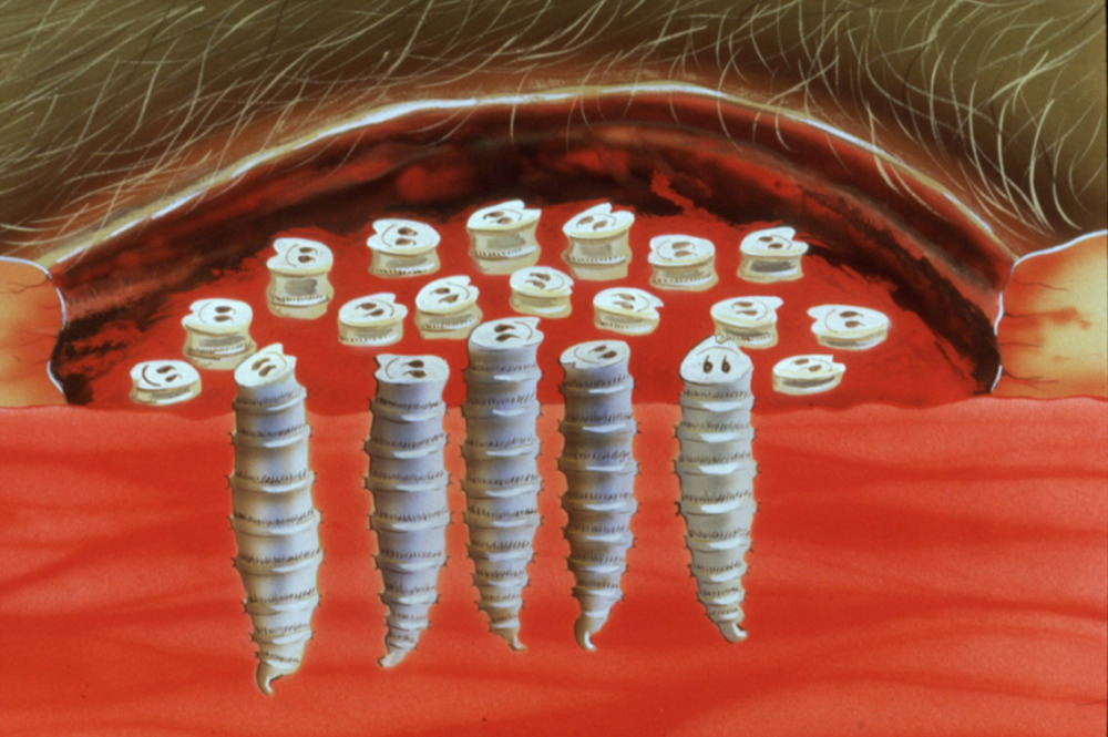 Screwworm larvae living in a wound