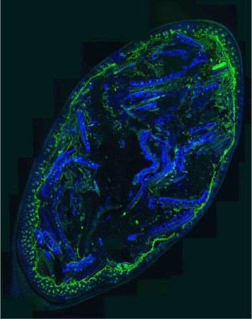 What Does Your Gut Microbiome Look Like?