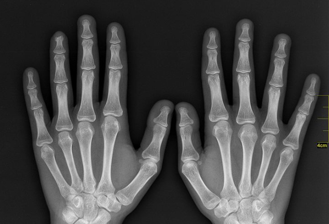 Scientists are putting the X factor back in X-rays