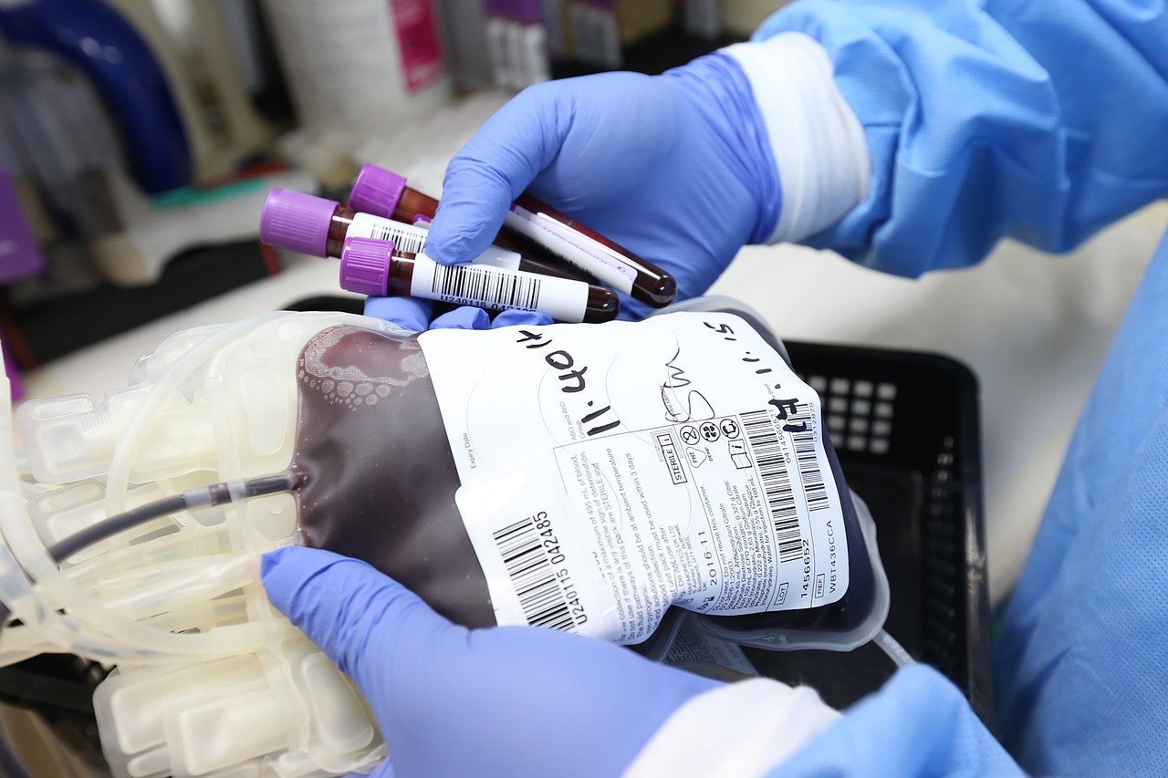 A bag and vials of donated blood