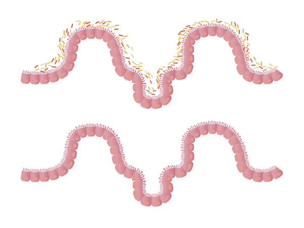 intestines microflora