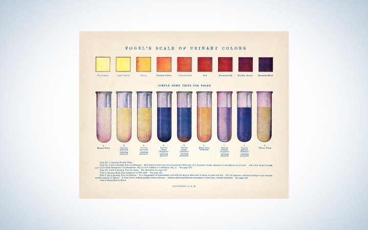  urine color chart