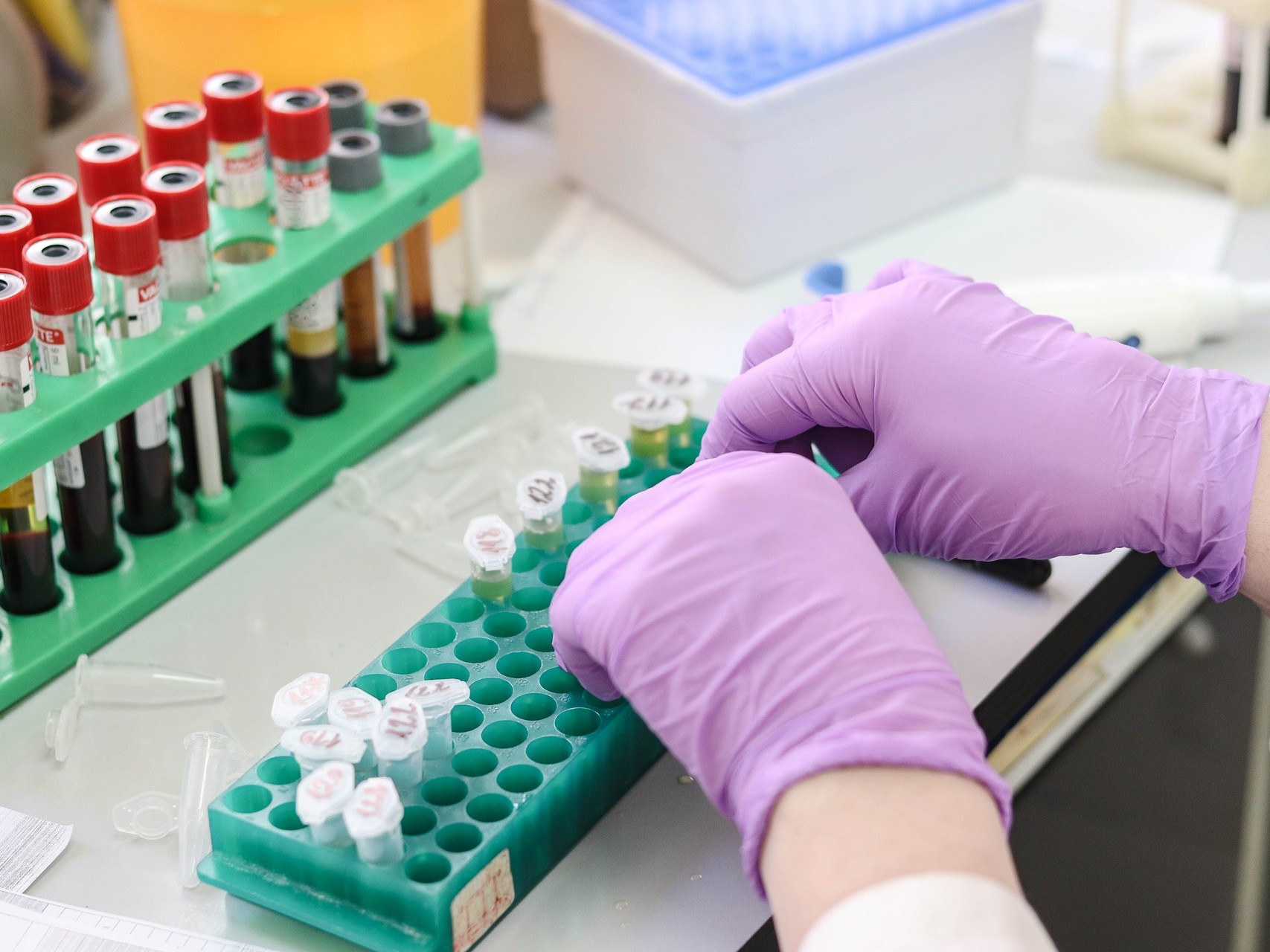 person handling blood samples in a lab