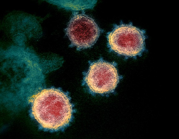 SARS-CoV-2 virus, the origin of the Omicron, BA.2, and Delta variants, under a microscope