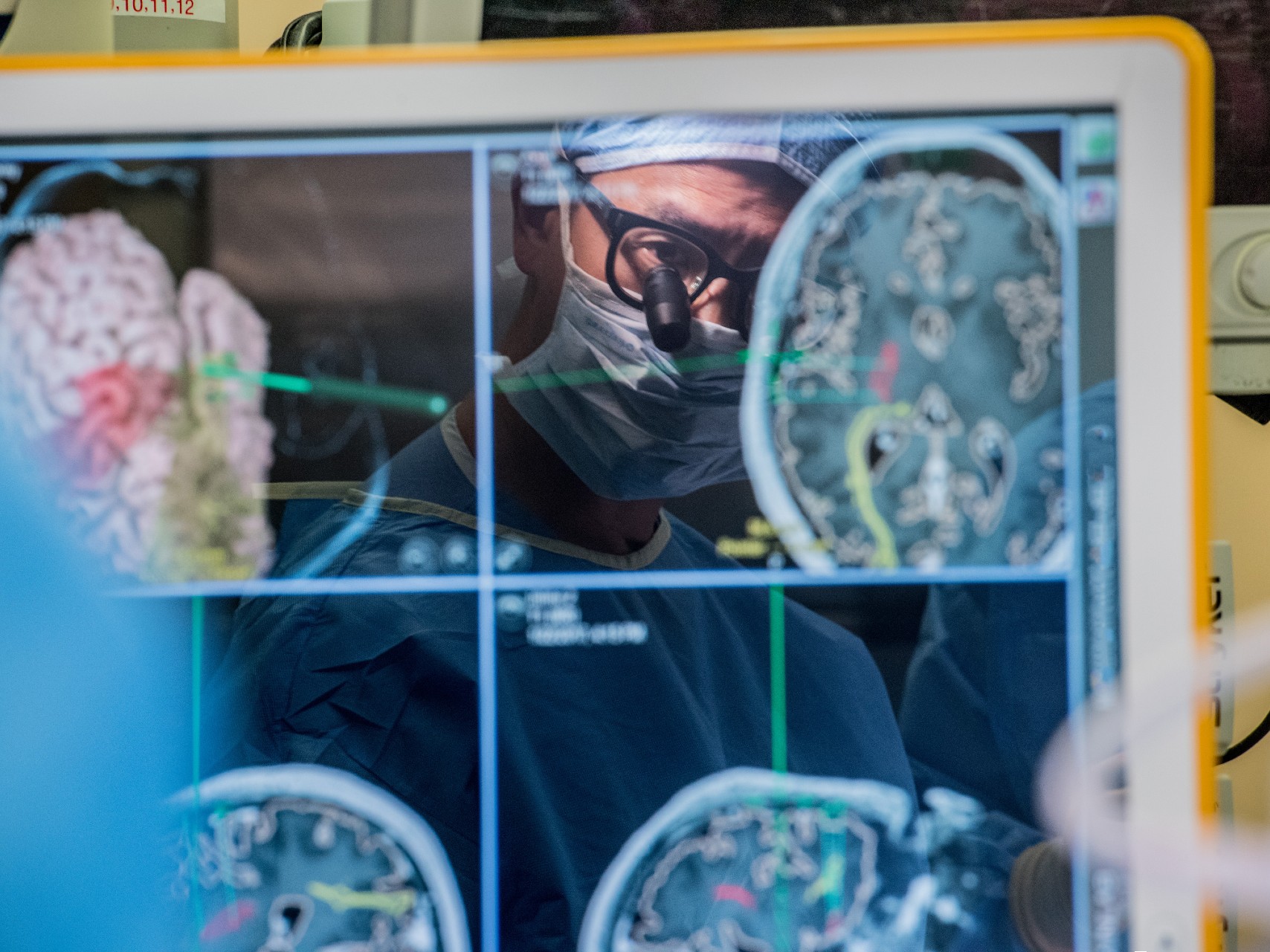 A doctor looks at images of a brain as he performs surgery.