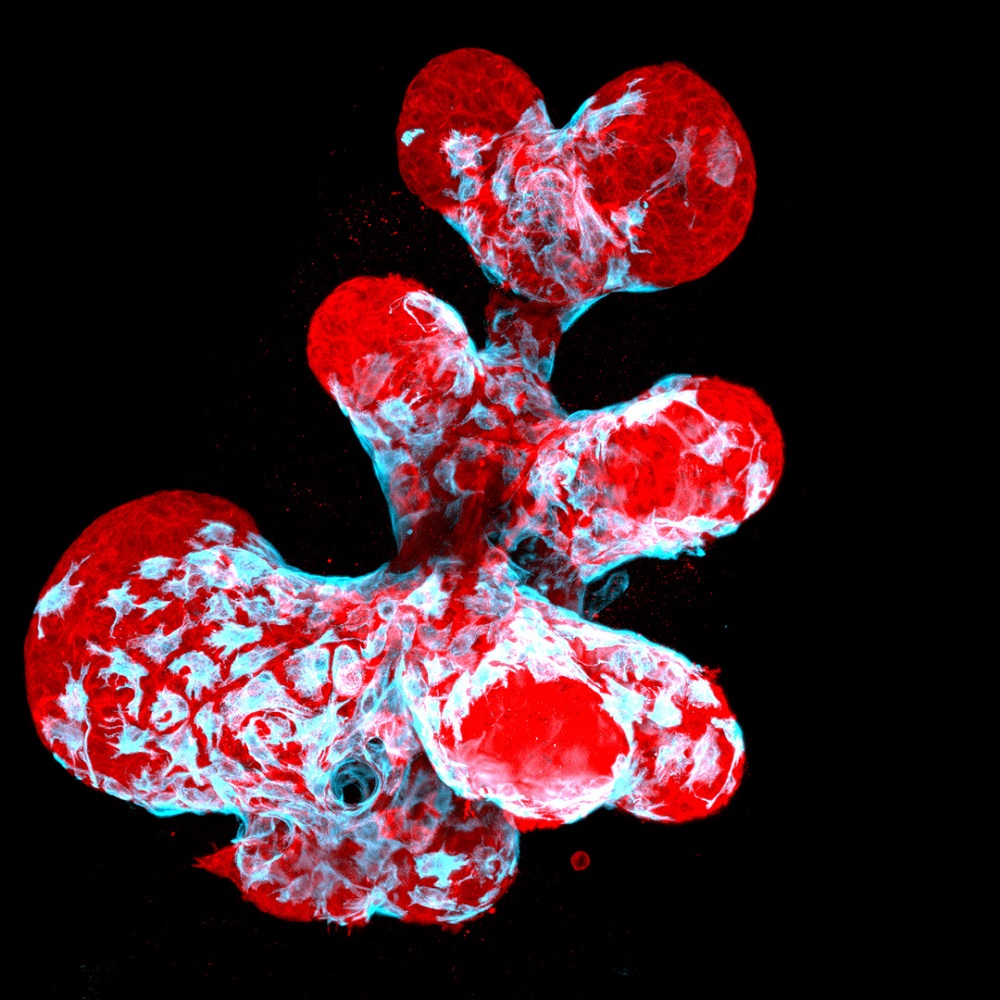 Breast organoid with red and blue sections