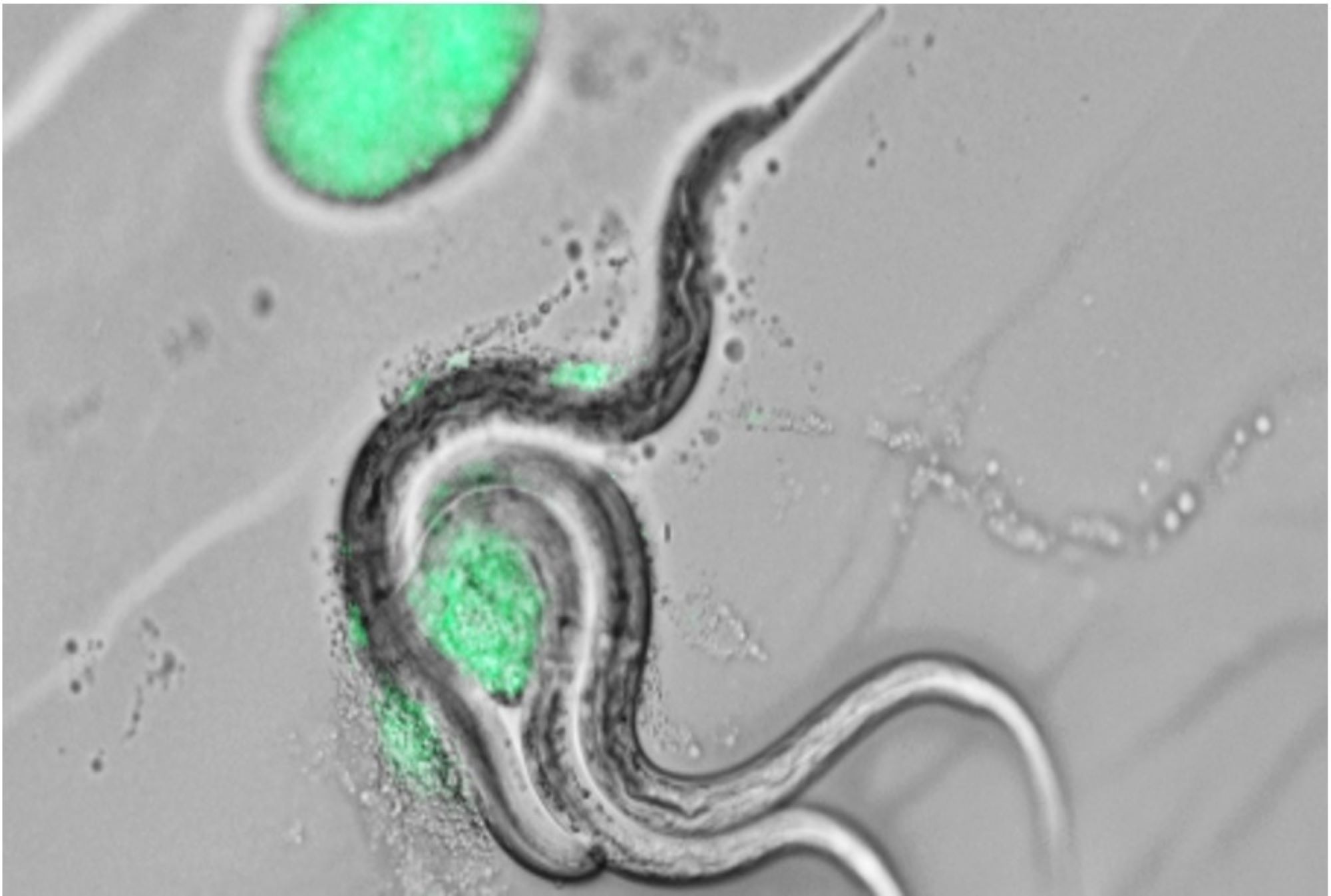 Fluorescent microscopy images of nematodes