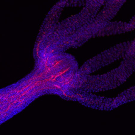 Hydras can regrow their heads. Scientists want to know how they do it.