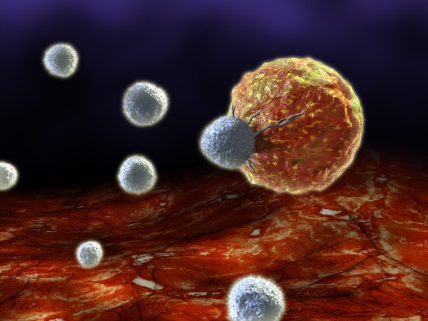 a graphic rendering of a orange-colored cancer cell being attacked by a gray immune cell