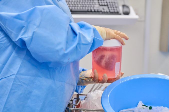 A pig's heart in a medical container held by a medical worker in blue protective clothing