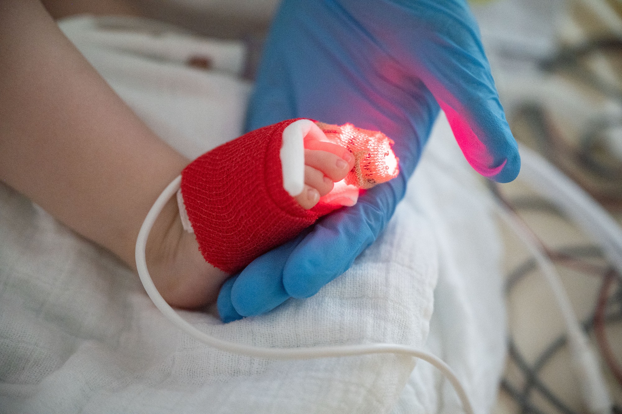 Baby with RSV in hospital ventilator. Nurse with blue glove is holding their foot.