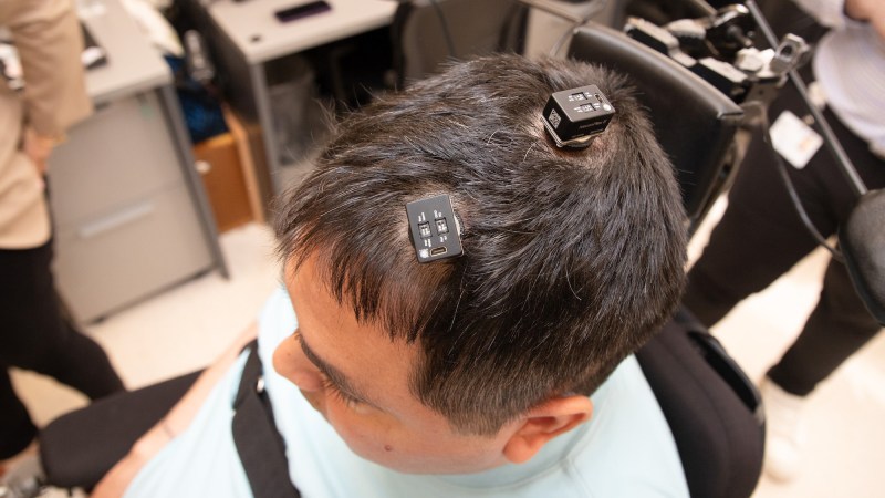 A new neural implant can translate brain activity in two languages