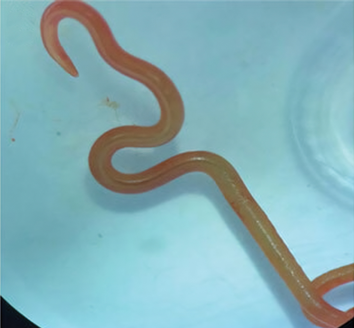 A live third-stage larval form of Ophidascaris robertsi that is about 3 inches long and only one millimeter in diameter. The worm is seen under a stereomicroscope.