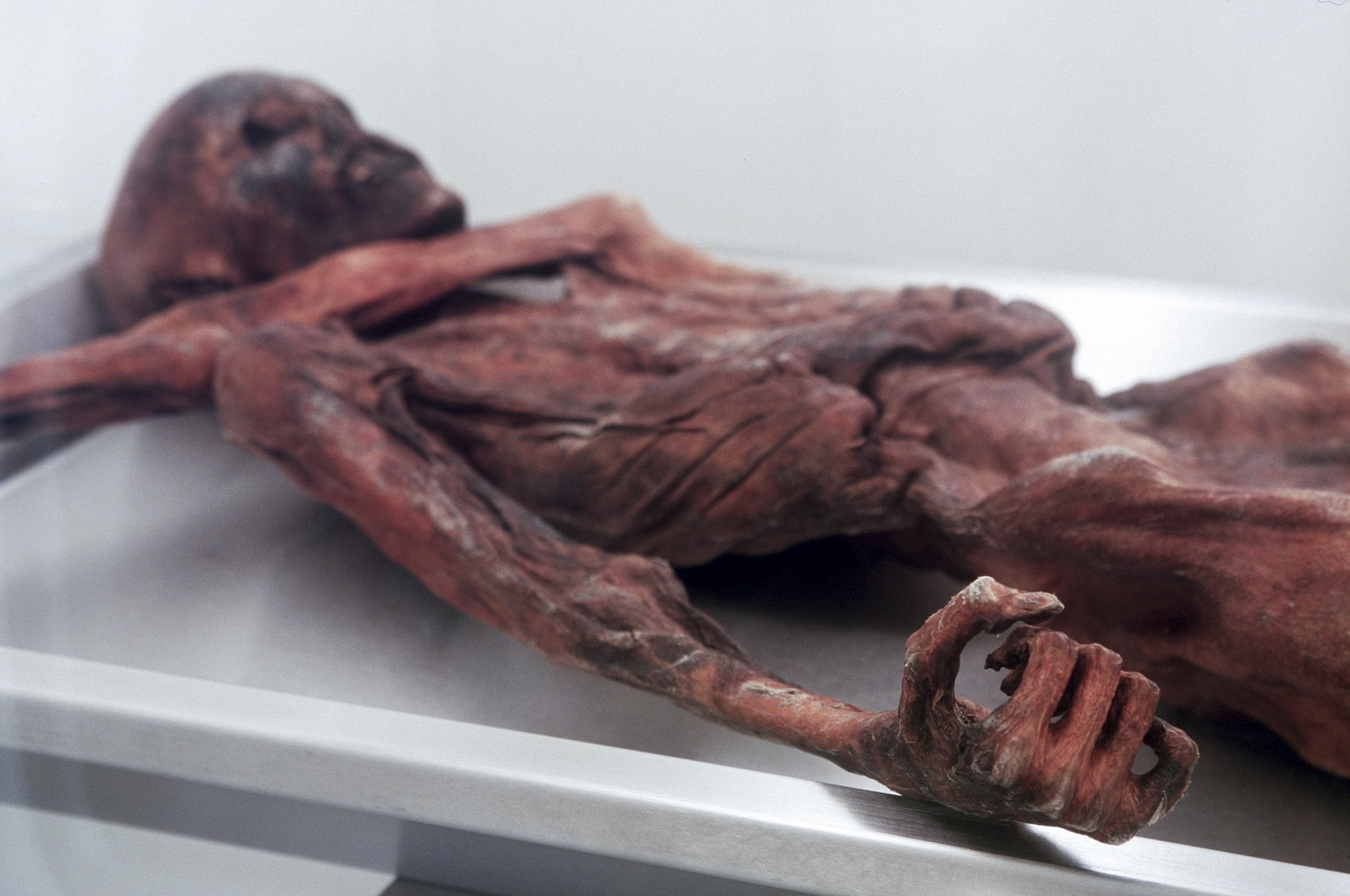 Otzi the Iceman remains laid out on a stretcher