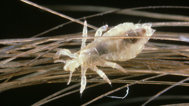 A louse on human hair under a microscope. Humans and lice have coevolved for thousands of years. The oldest human louse known to scientists is a 10,000 year-old specimen from Brazil.