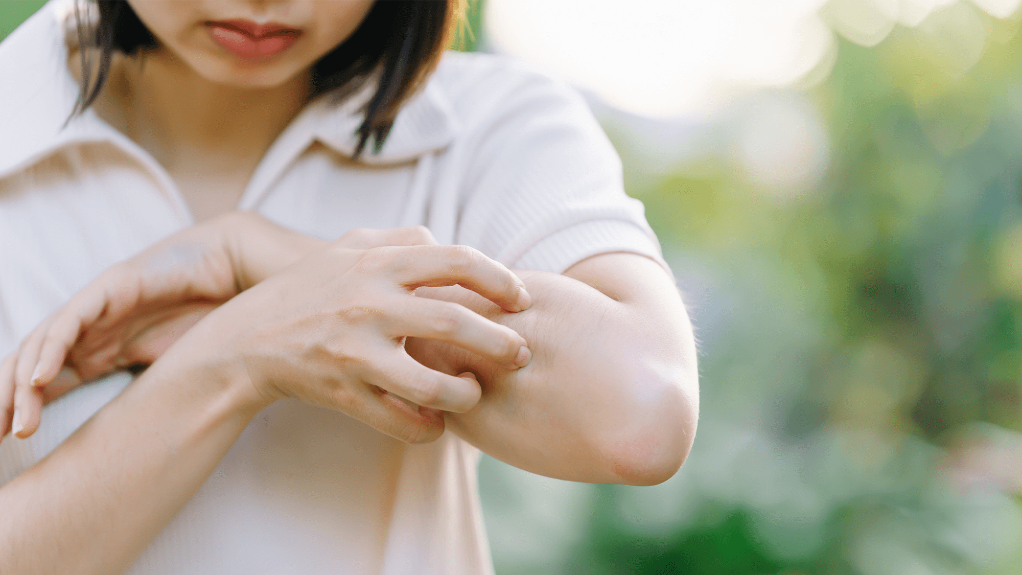 A woman scratches her forearm.