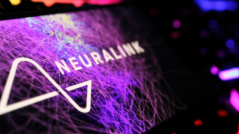 85% of Neuralink implant wires are already detached, says patient