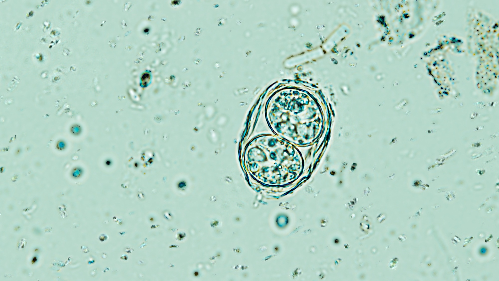 Toxoplasma gondii oocyst under the microscope, isolated