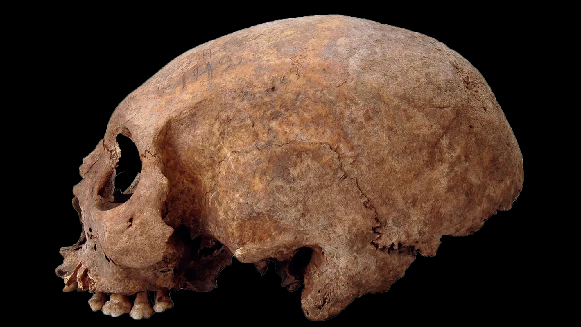 cone shaped skull 2