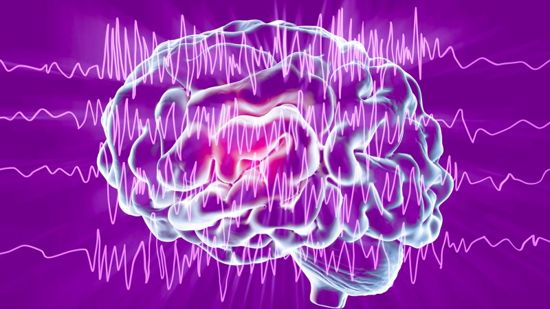 Brain and brain waves in epilepsy, computer illustration. This EEG (electroencephalogram) illustration shows generalized epilepsy, affecting the whole brain cortex: all the EEG traces show chaotic brain waves. Epilepsy can take many forms, and have different effects. This could illustrate both benign epilepsy (inherited childhood form that normally improves with age), and myoclonic epilepsy (form that causes muscle contractions). An EEG measures electrical activity in the brain using electrodes attached to the scalp.