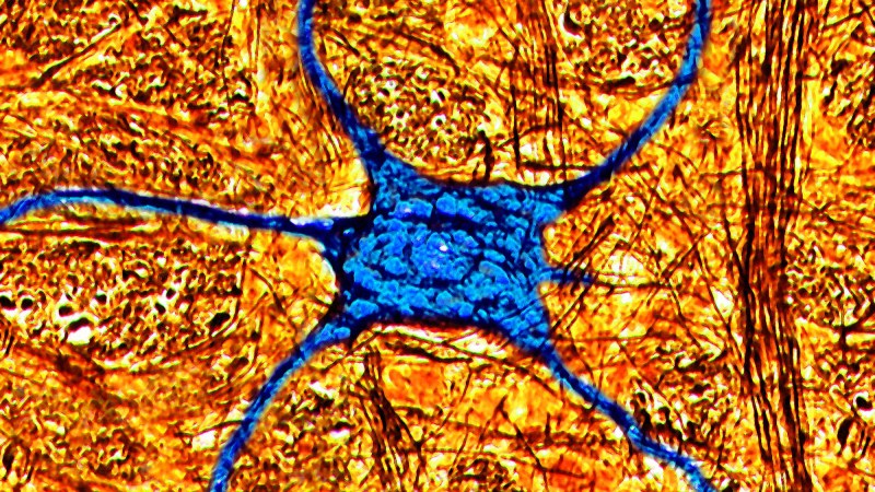 Close up of human brain neuron