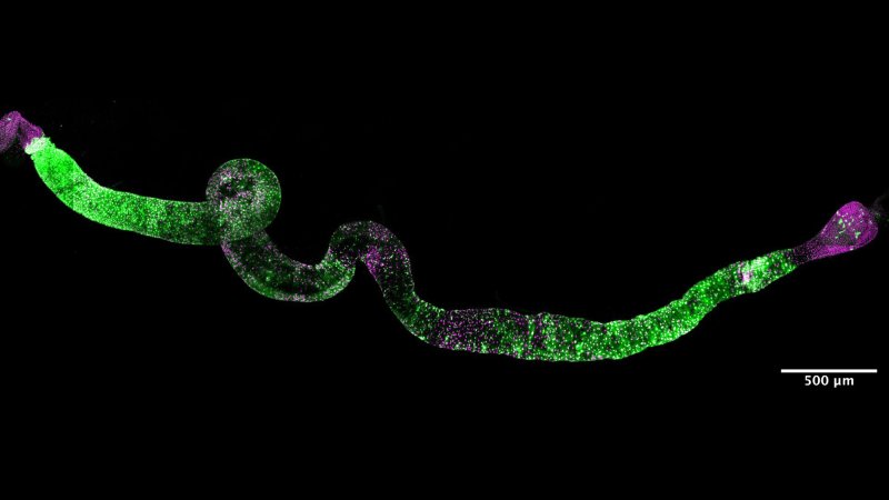 a fruit fly intestine. it is a long and narrow coiled tube with green coloration from dye