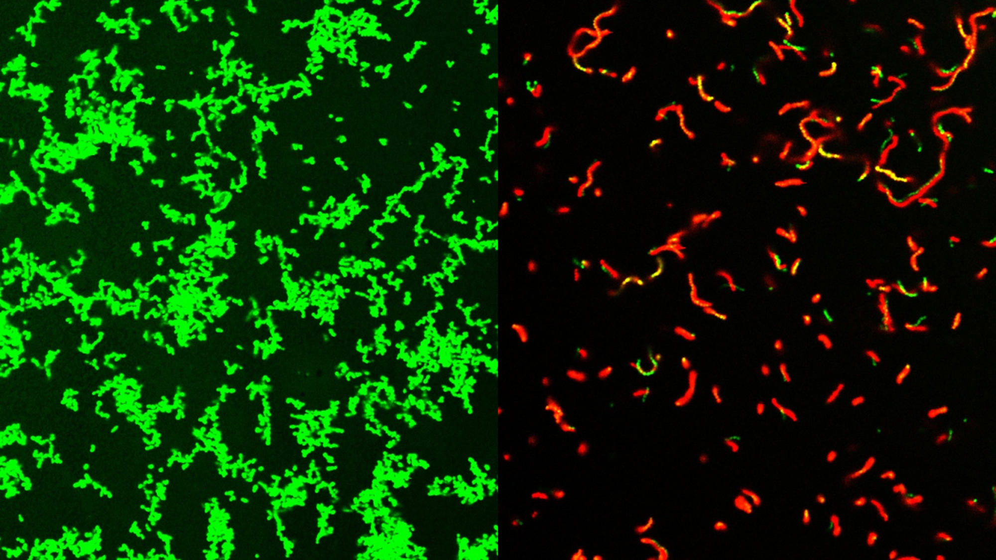 Researchers at Washington University School of Medicine in St. Louis have developed a compound that is effective against common bacteria that can lead to rare, dangerous illnesses. This image shows untreated Streptococcus pyogenes bacterial culture full of healthy microbes, labeled green (left). After treatment by GmPcide, the dish is full of dead bacteria (red; right).