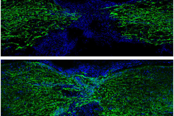 De bovenste afbeelding toont fluorescent gelabelde cellen in het ruggenmerg van een zebravis die een week na het letsel herstelt, en het onderste beeld toont het herstel vier weken na het letsel. KREDIET: Mokalled Lab.