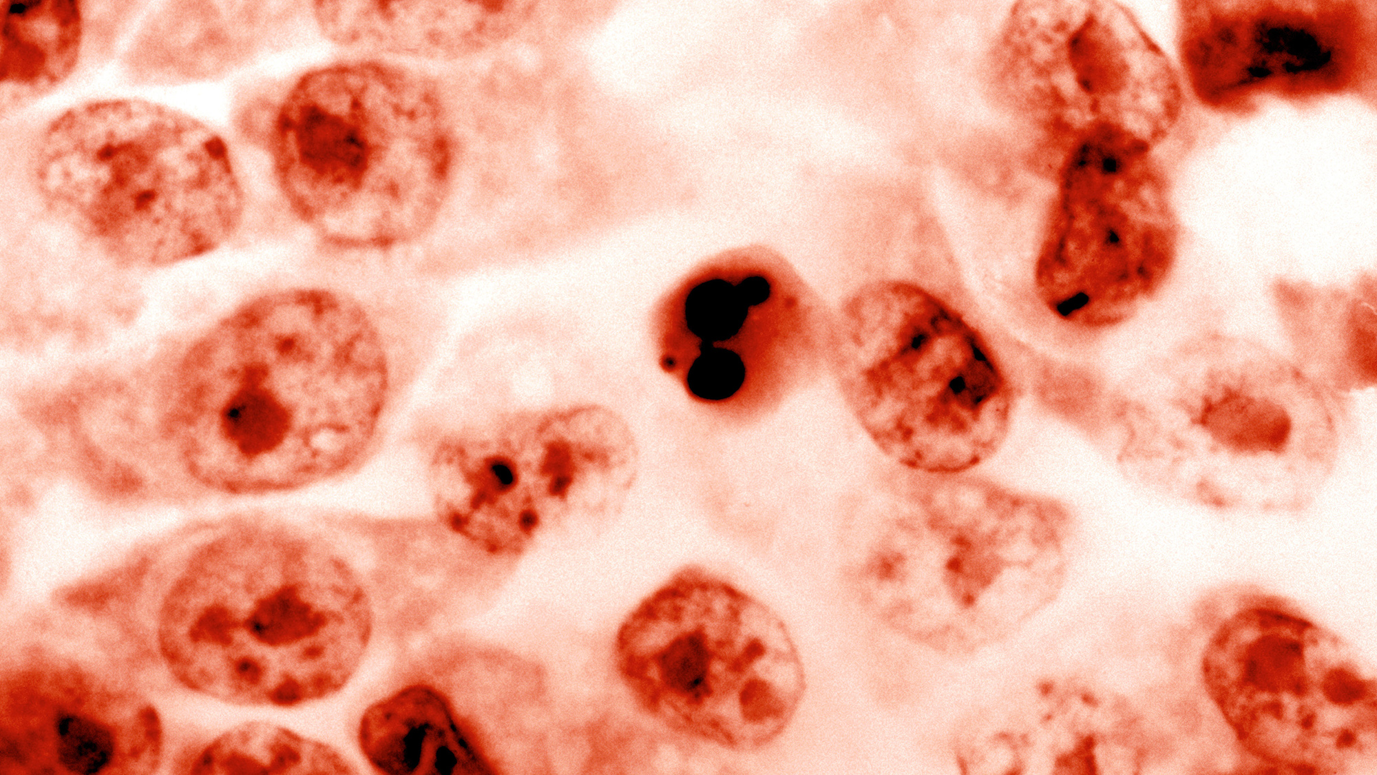 A cell undergoing apoptosis is seen in the center of the image surrounded by other normal cells.Shaded Lighter.