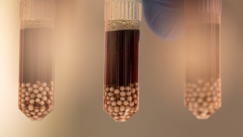 A lab technologist with the Louisville Metro Department of Public Health and Wellness holds test tubes full of liquified mosquito remains in a lab at Health Department headquarters in Louisville, Kentucky.