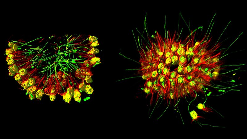 choanoflagellate Choanoeca flexa